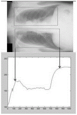 X-ray chest radiography lung segmentation method and device