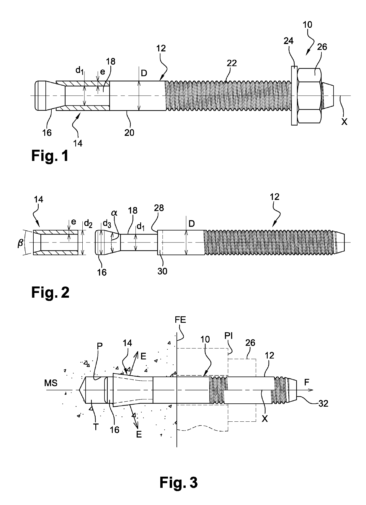 Expanding wall anchor and use for fixing a component to a support material