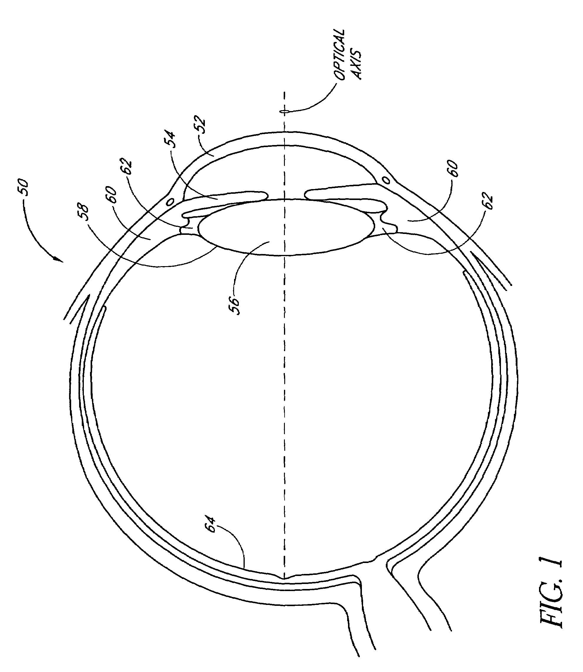 Single-piece accommodating intraocular lens system