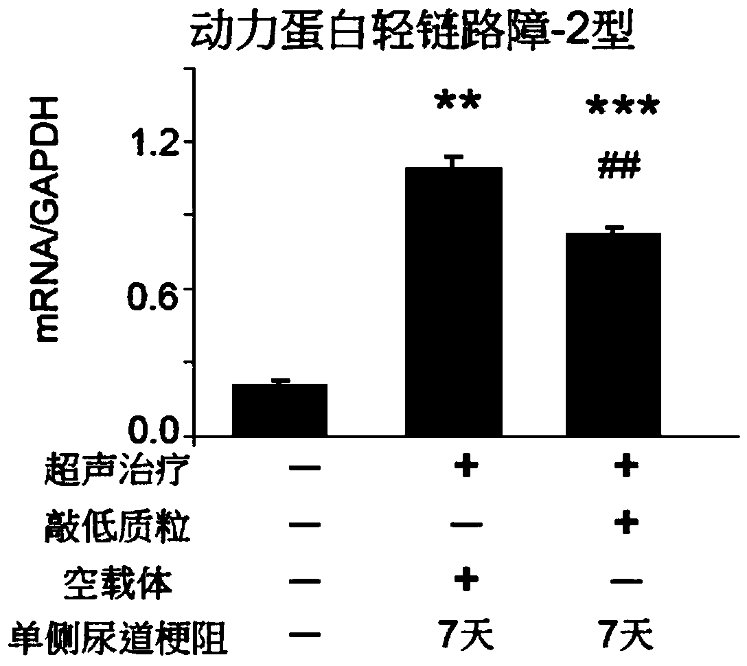 Application of dynein light chain roadblock-type 2 in preparation of medicine treating kidney failure and the medicine thereof