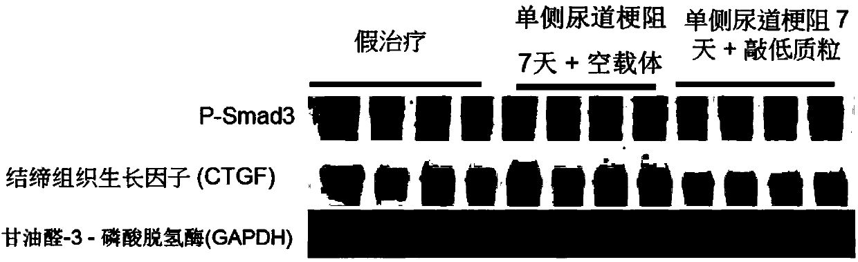 Application of dynein light chain roadblock-type 2 in preparation of medicine treating kidney failure and the medicine thereof