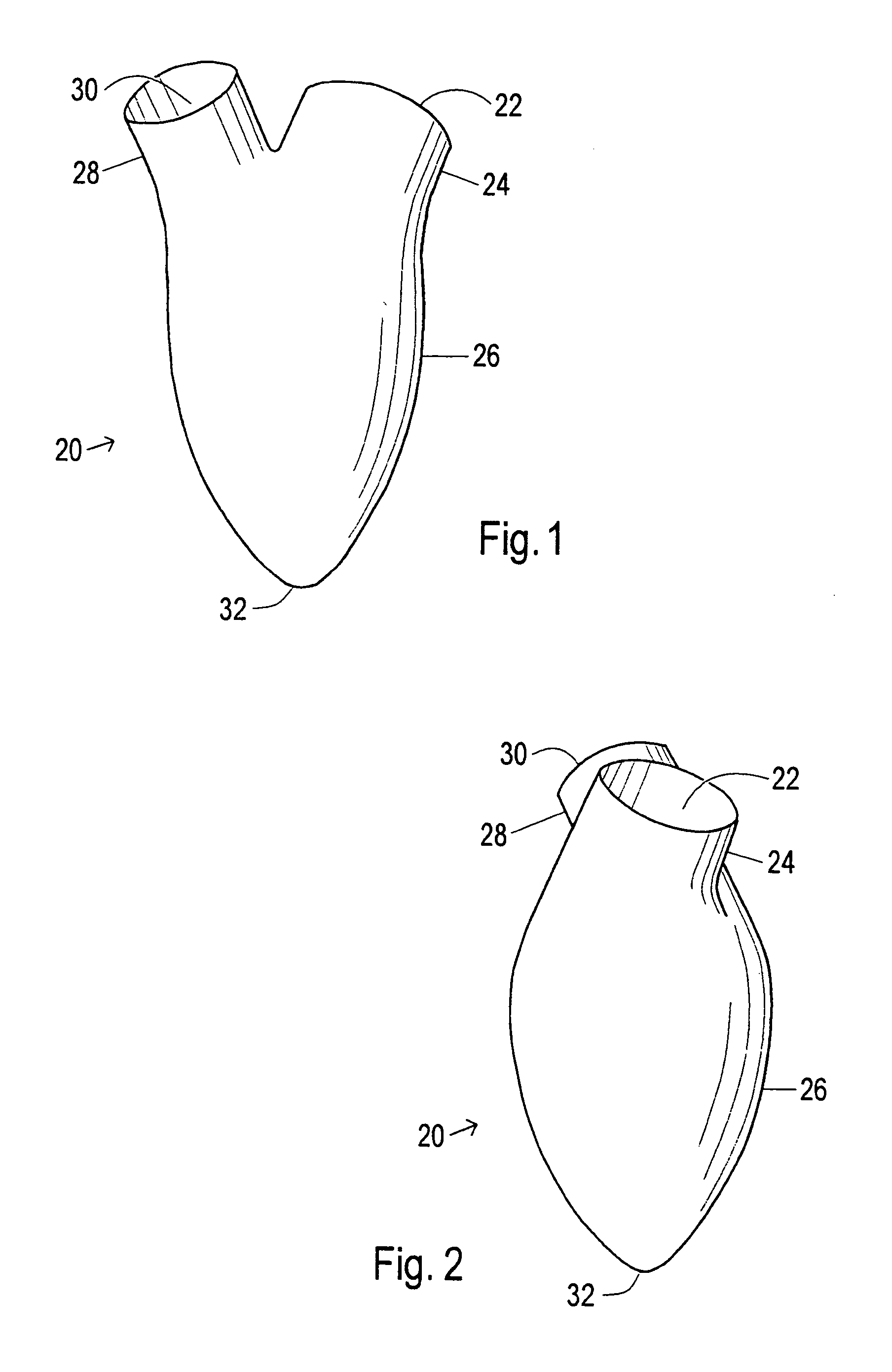 Device and method to control volume of a ventricle