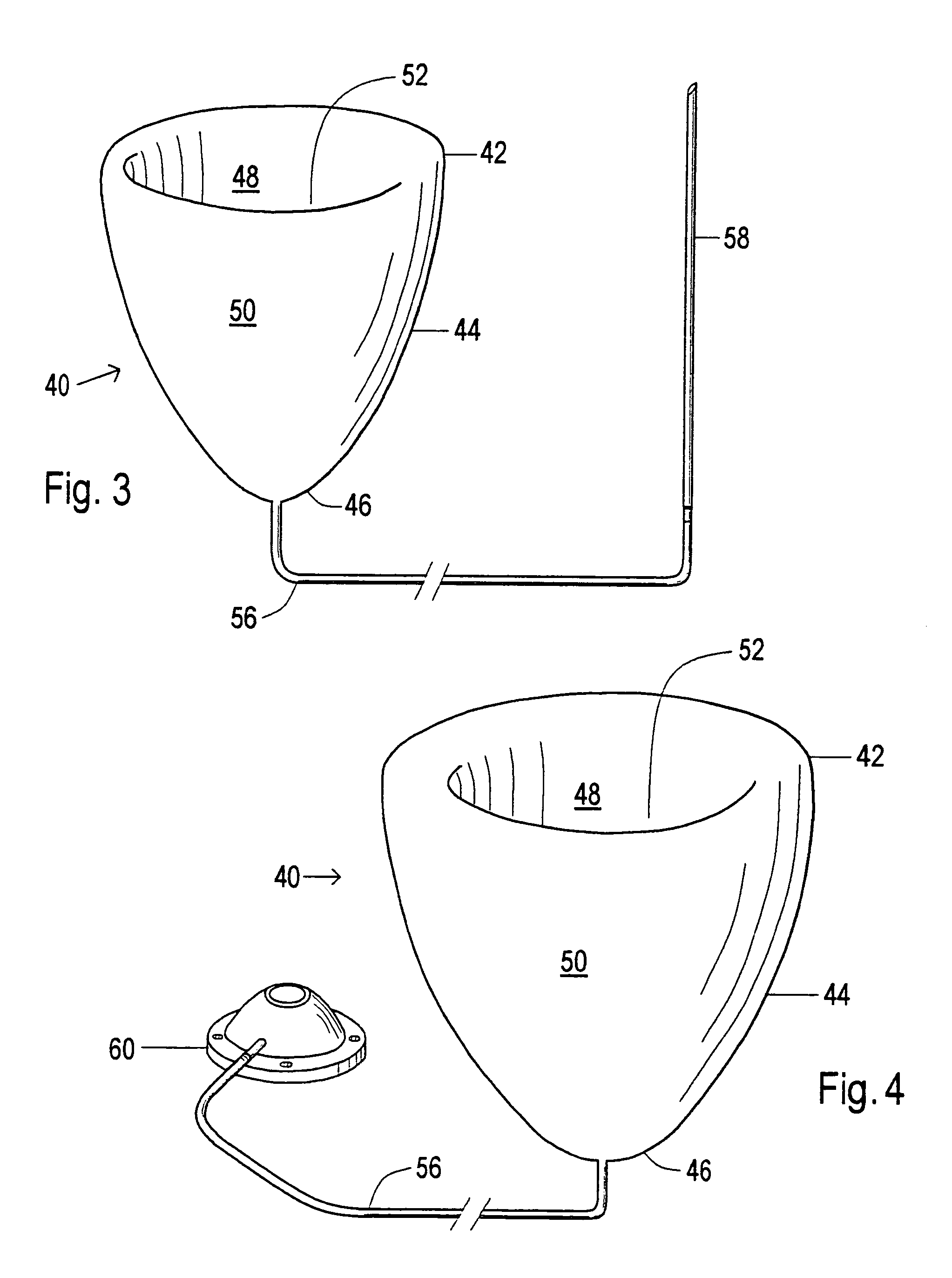 Device and method to control volume of a ventricle