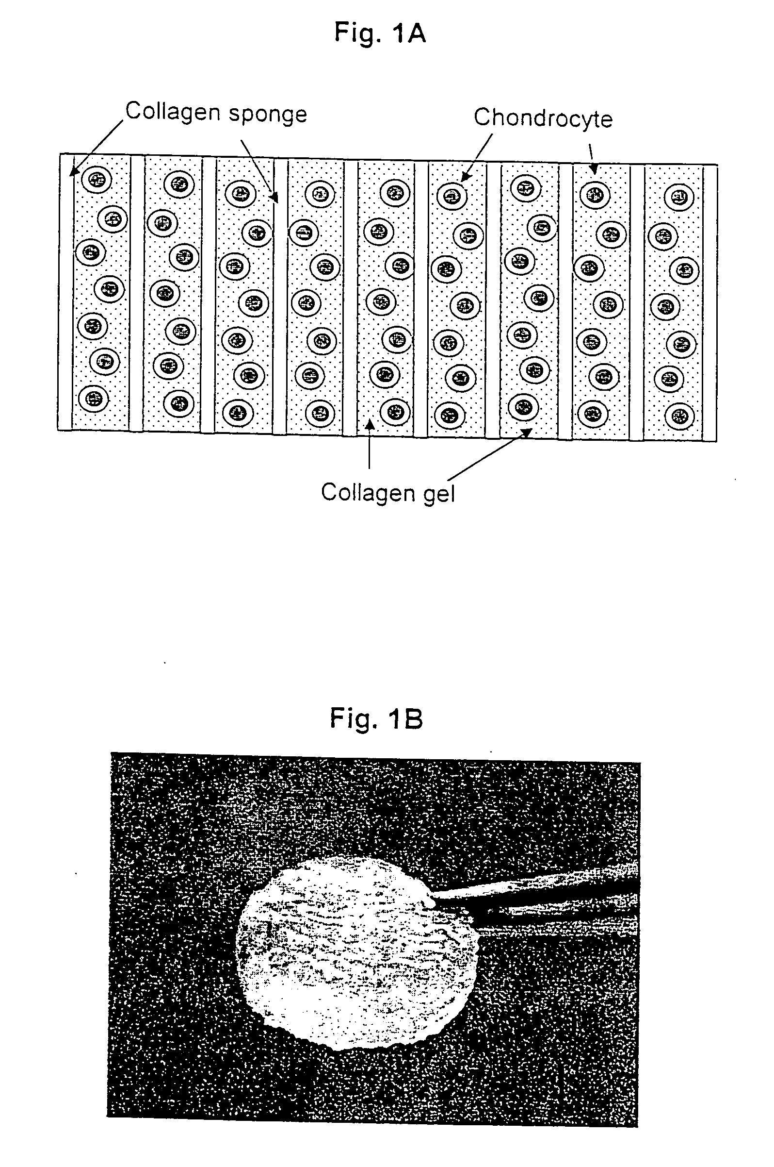 Method for preparation of neo-cartilage constructs