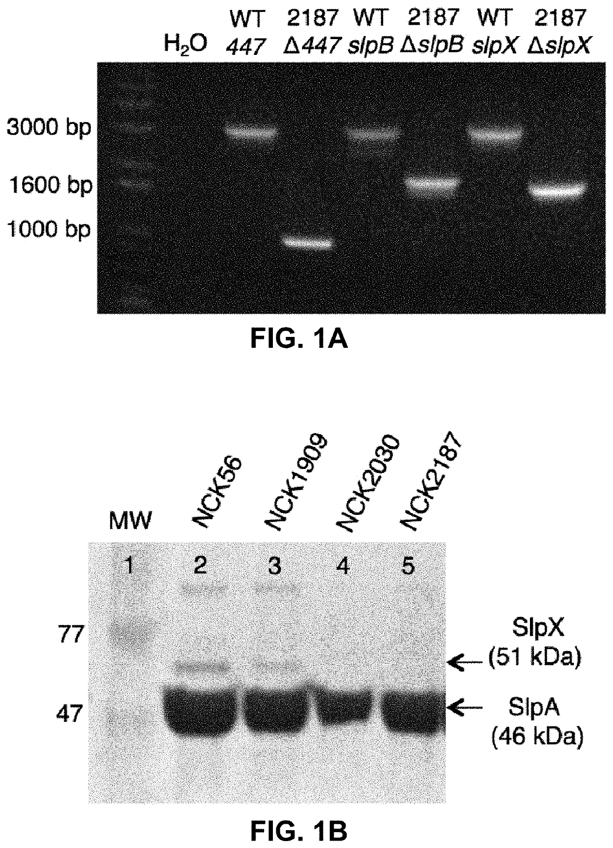 <i>Lactobacillus acidophilus </i>surface layer protein A (SlpA) as a therapeutic agent for the treatment of inflammatory diseases