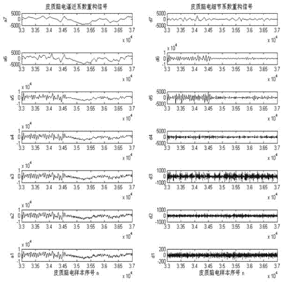 Intraoperative motor area function localization system based on cortex electroencephalogram mu rhythm wavelet analysis