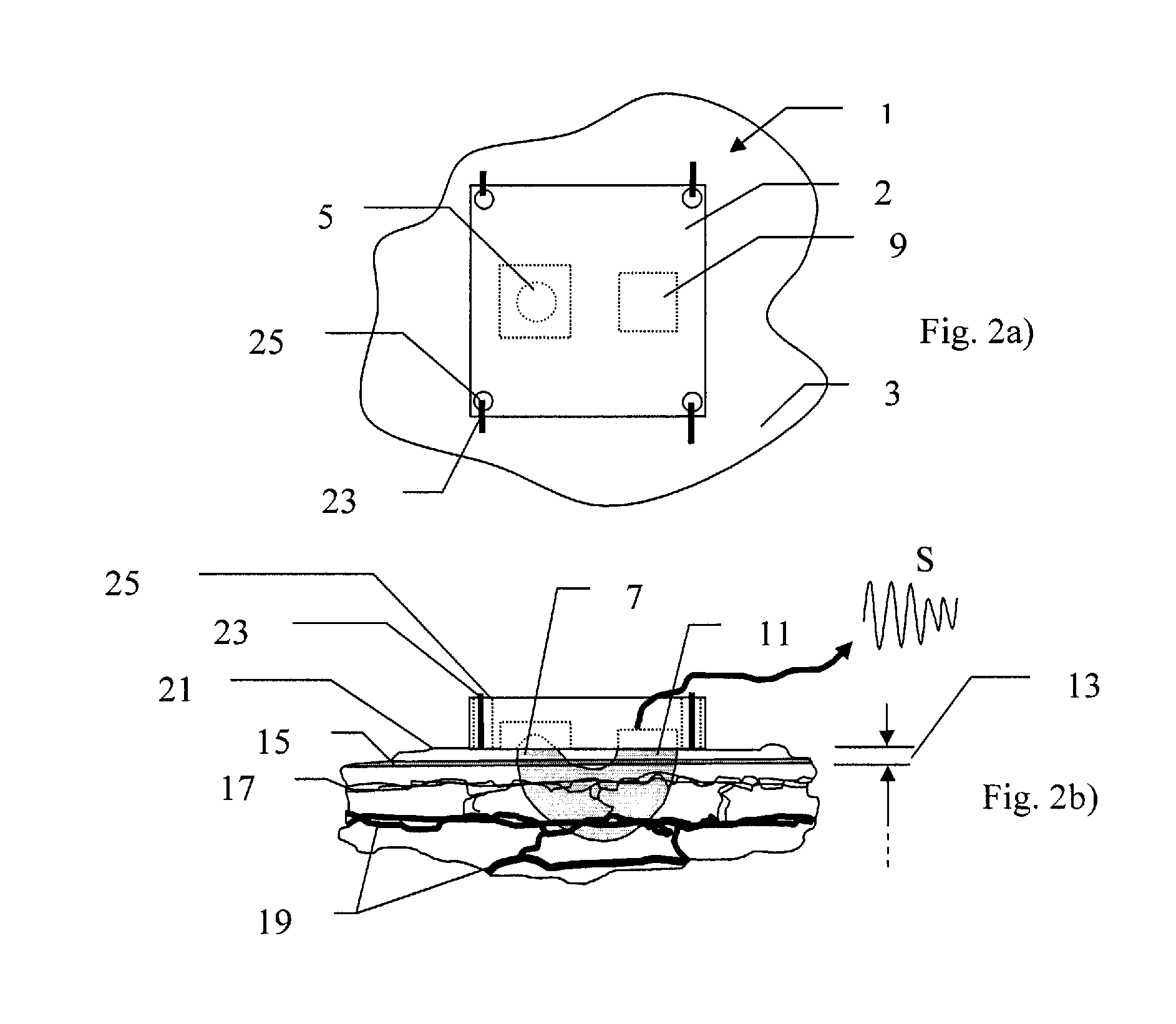 Method and device to detect eating, to control artificial gastric stimulation