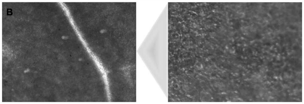 Method for observing egg laying amount of Frankliniella occidentalis