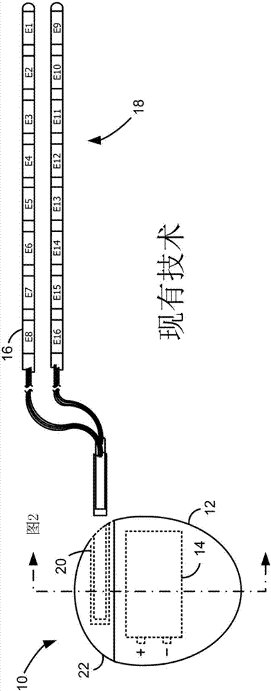 Assembly with a coaxial audio connector for charging an implantable medical device