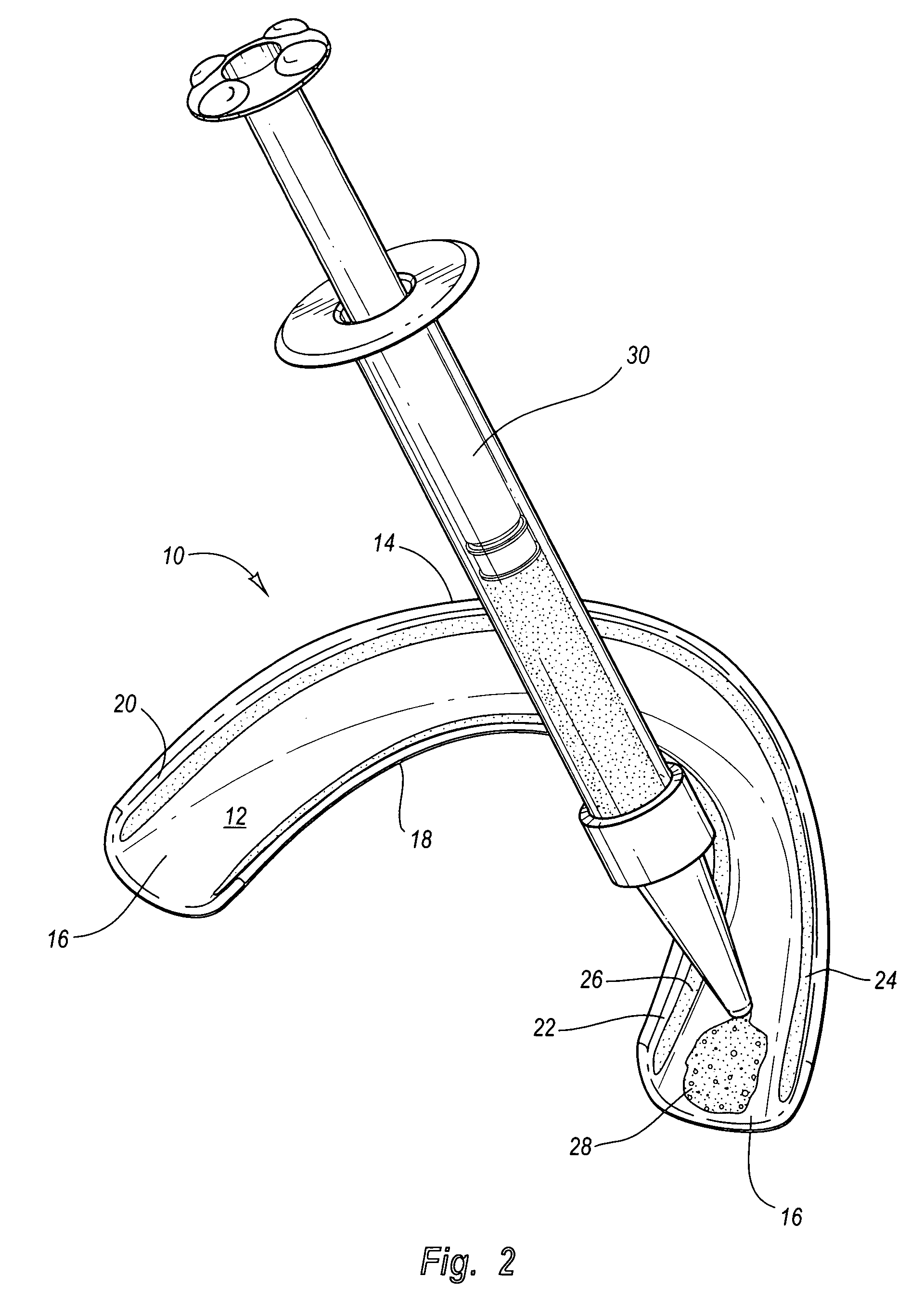 Treatment devices for providing oral treatments and kits and methods that utilize such treatment devices