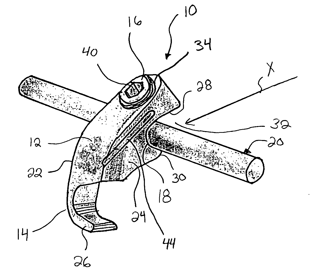 Spinal fixation hooks and method of spinal fixation