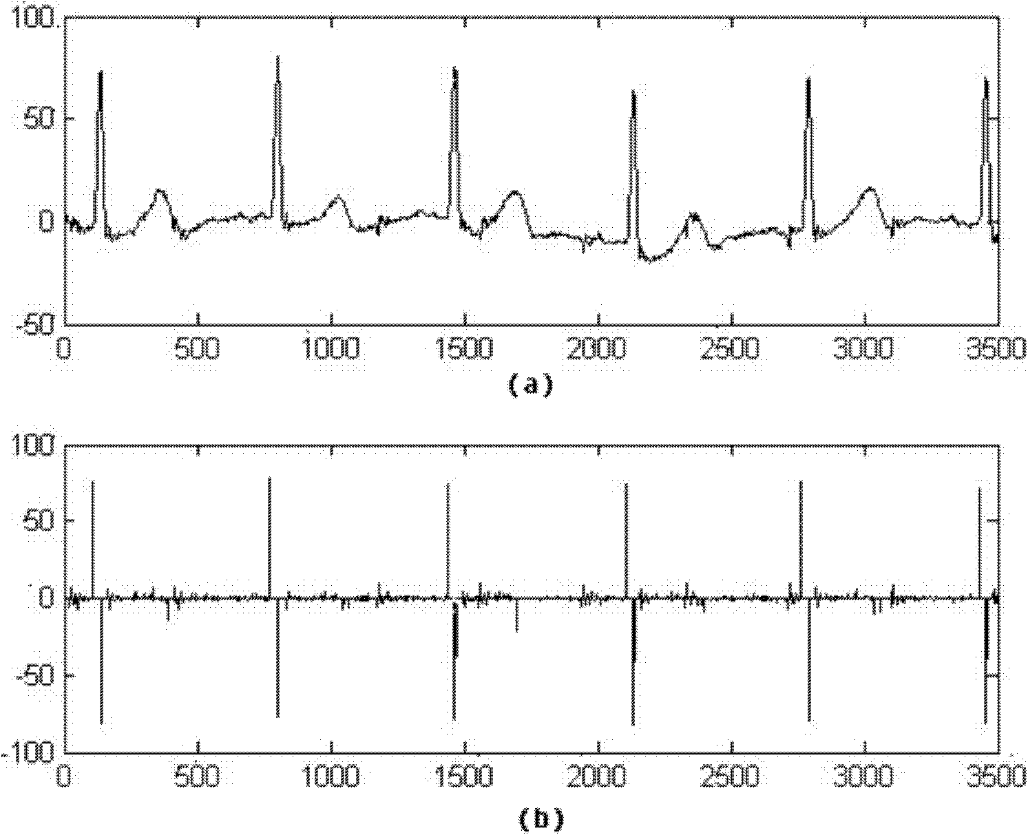 A discriminative method for time domain sparsity linear aliasing blind separation model of fetal heart rate detection