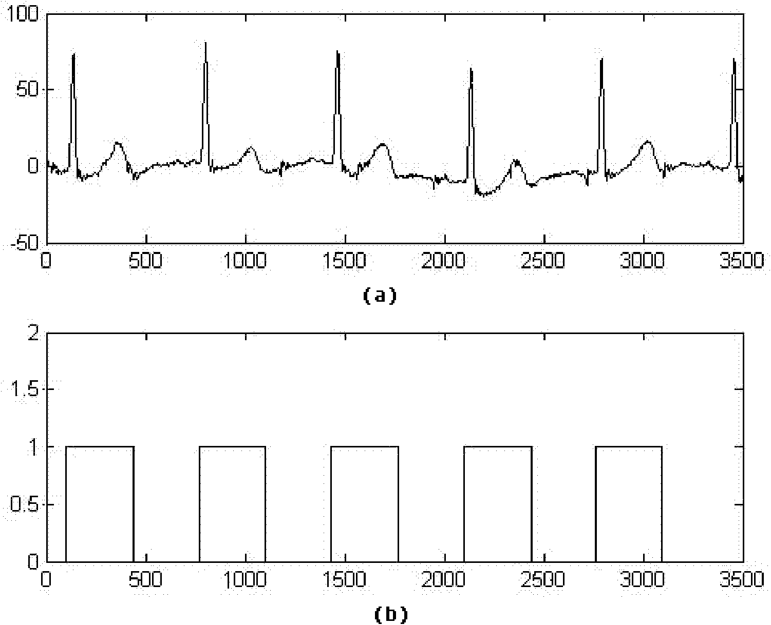 A discriminative method for time domain sparsity linear aliasing blind separation model of fetal heart rate detection