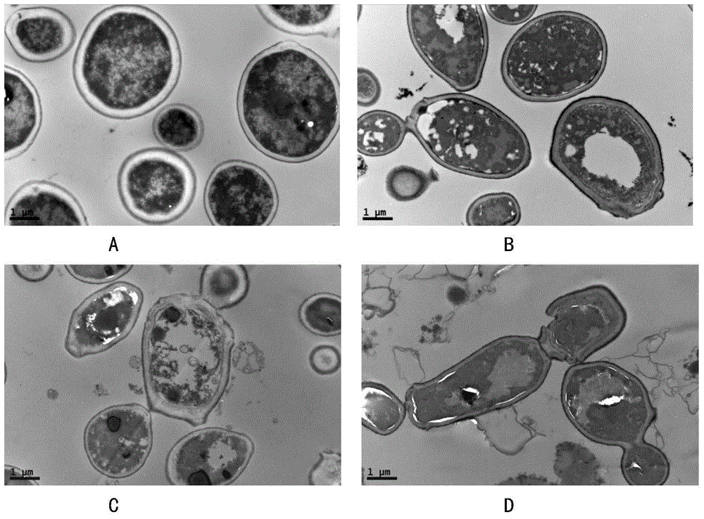 Traditional Chinese medicine composition resistant to pathogenic microorganisms and preparation method and application of traditional Chinese medicine composition