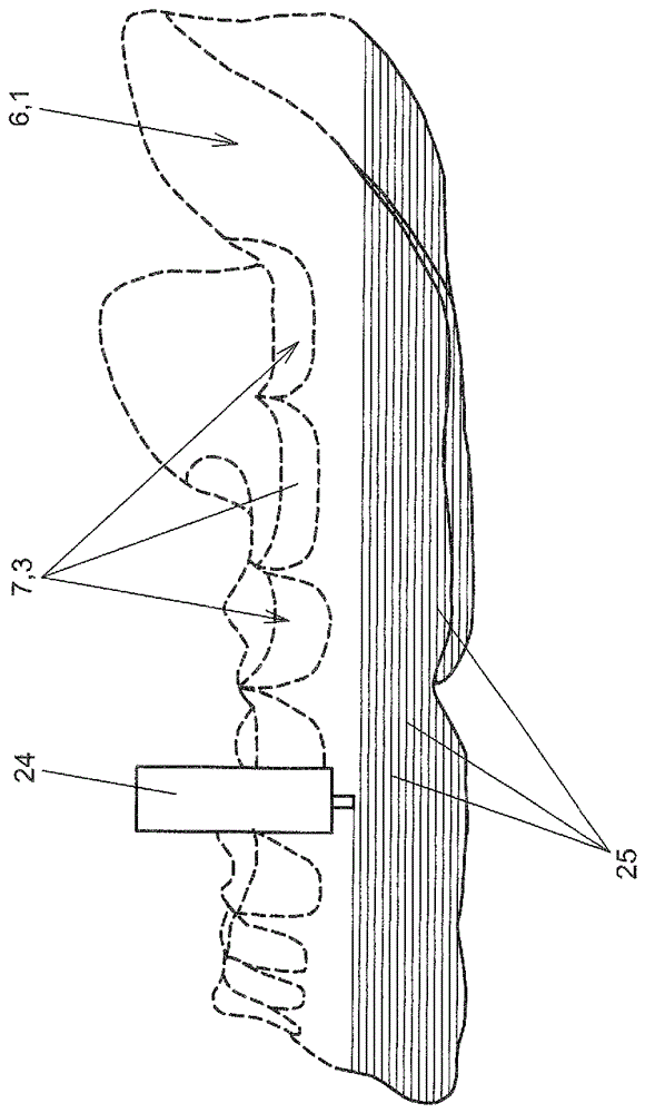 Method for producing a prosthesis base