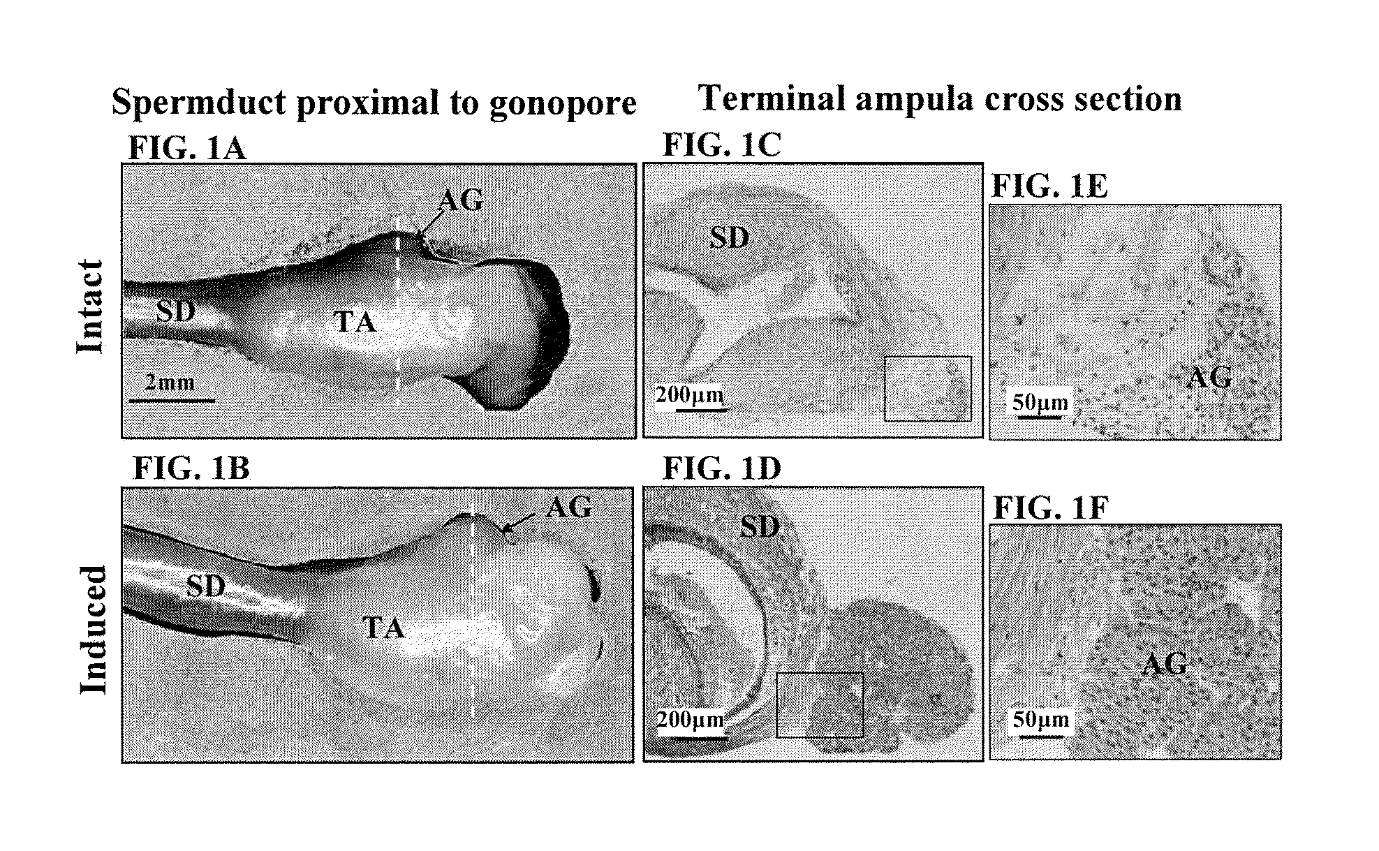 Insulin-like gene in prawns and uses thereof