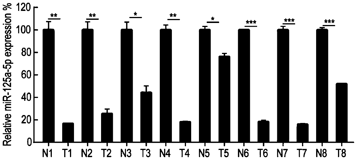 Hepatoma diagnosis kit for detecting microRNA expression level and application thereof