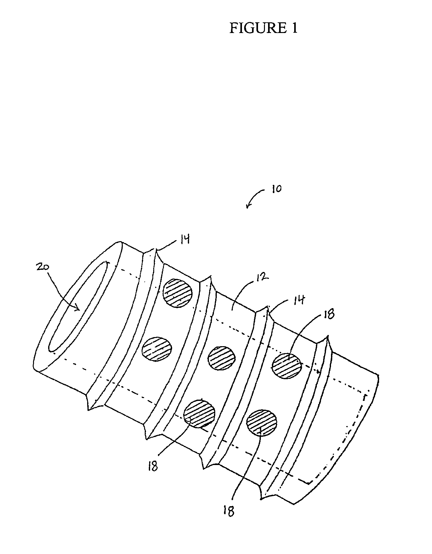 Spinal baseplates with ball joint coupling and a retaining member