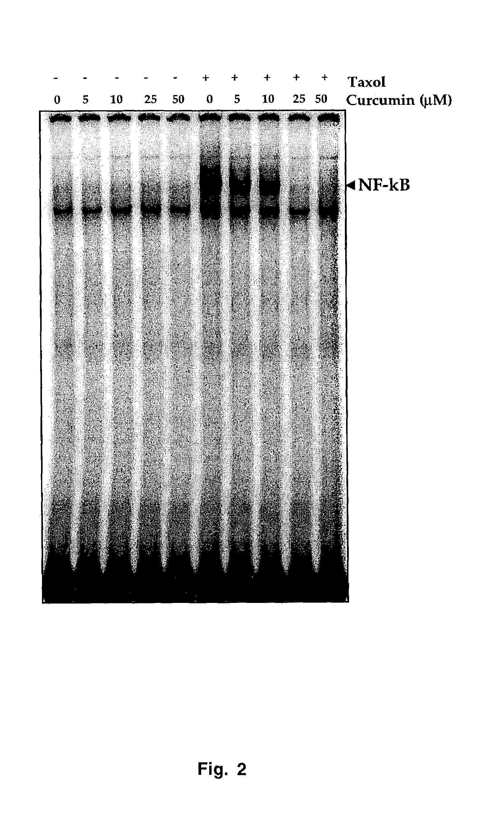 Synergistic effects of nuclear transcription factor NF-κB inhibitors and anti-neoplastic agents