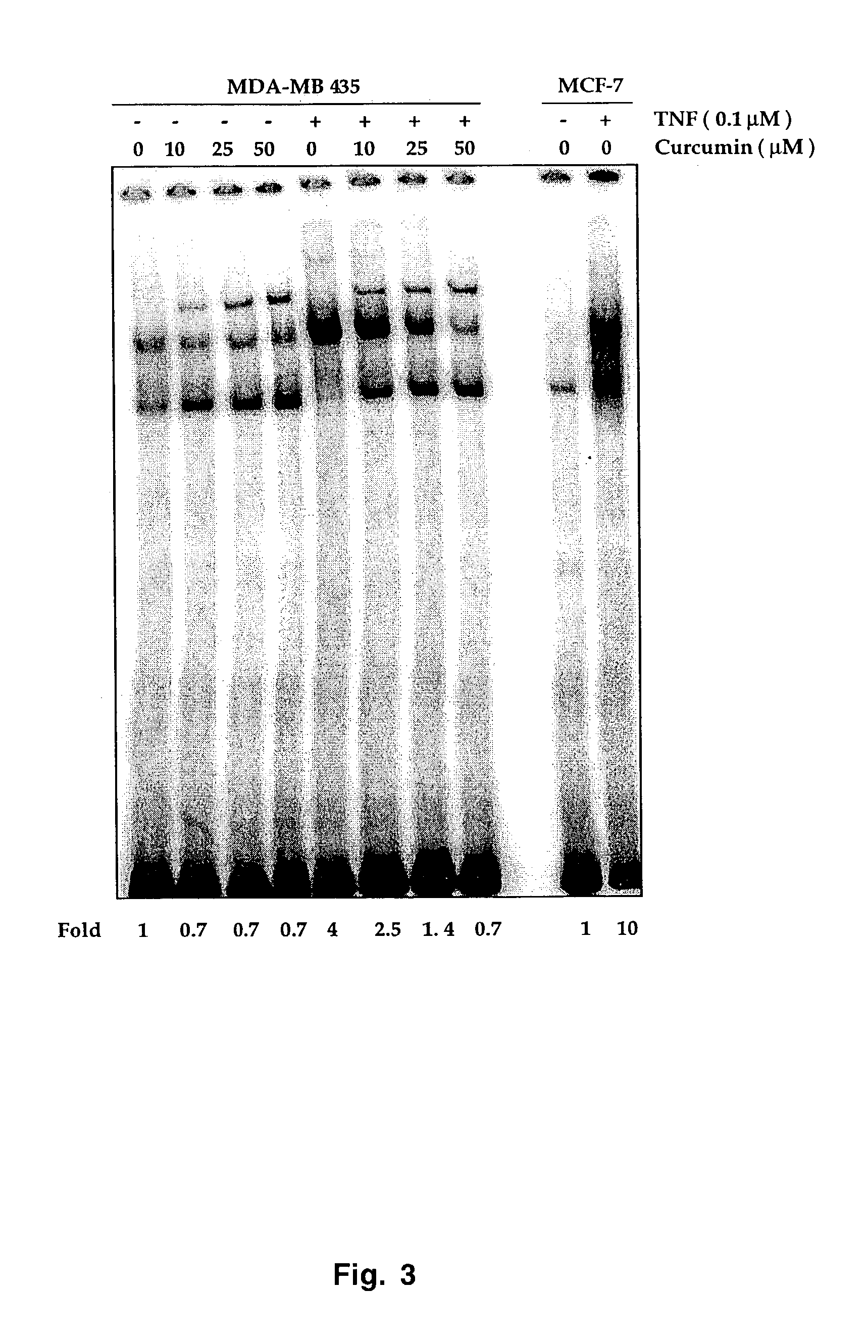 Synergistic effects of nuclear transcription factor NF-κB inhibitors and anti-neoplastic agents