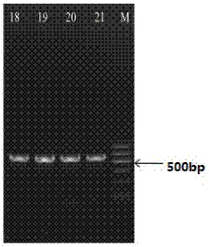 A kind of method for detecting Lactobacillus casei bacterial strain and its kit and primer pair