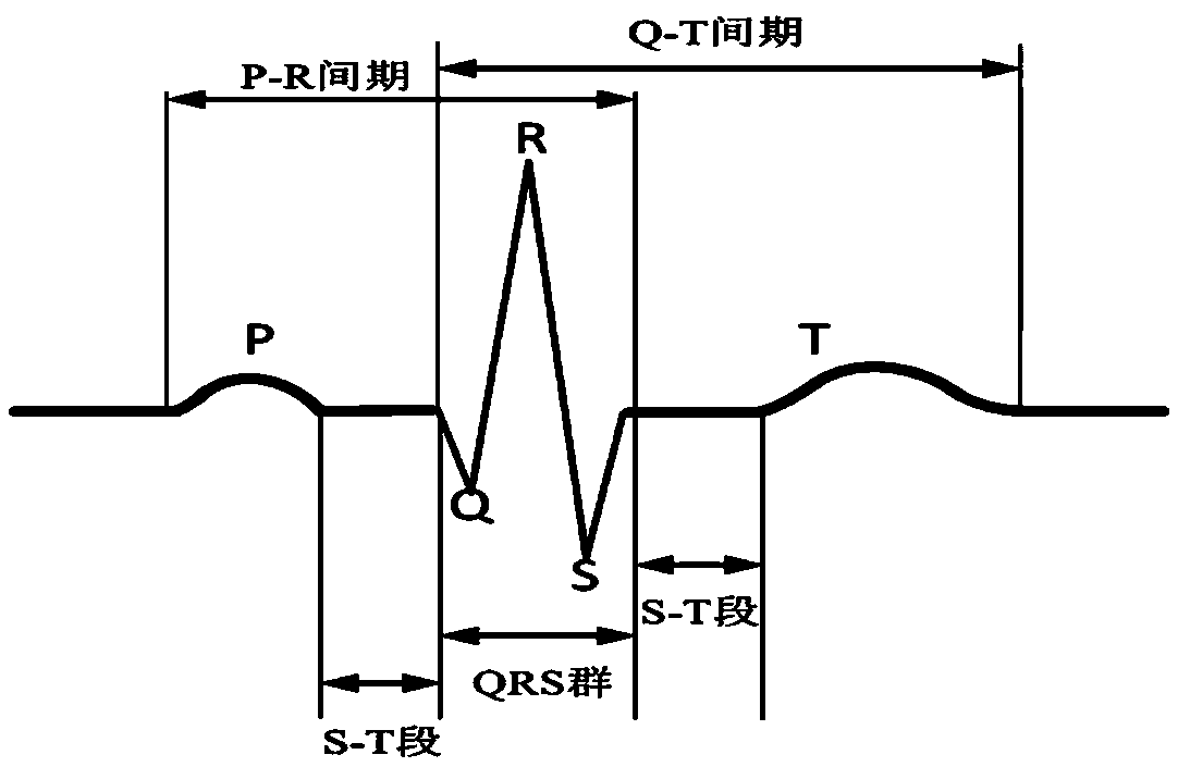 Automatic denoising method of electrocardiogram signals