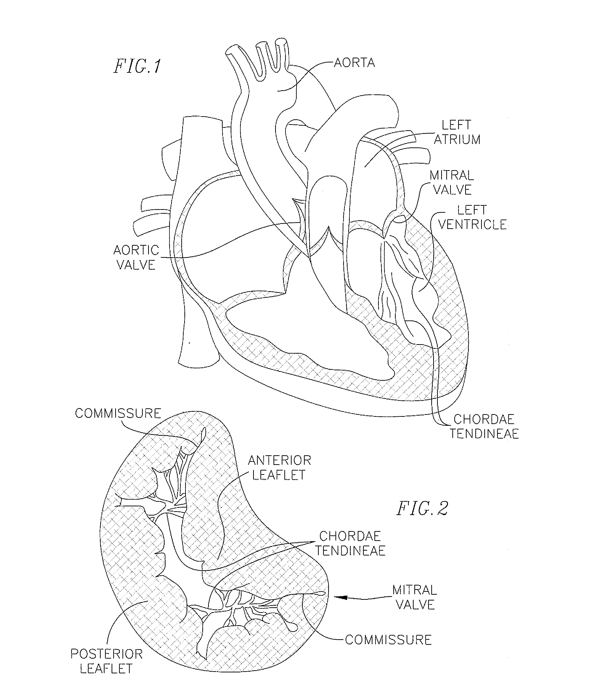 Mitral repair and replacement devices and methods