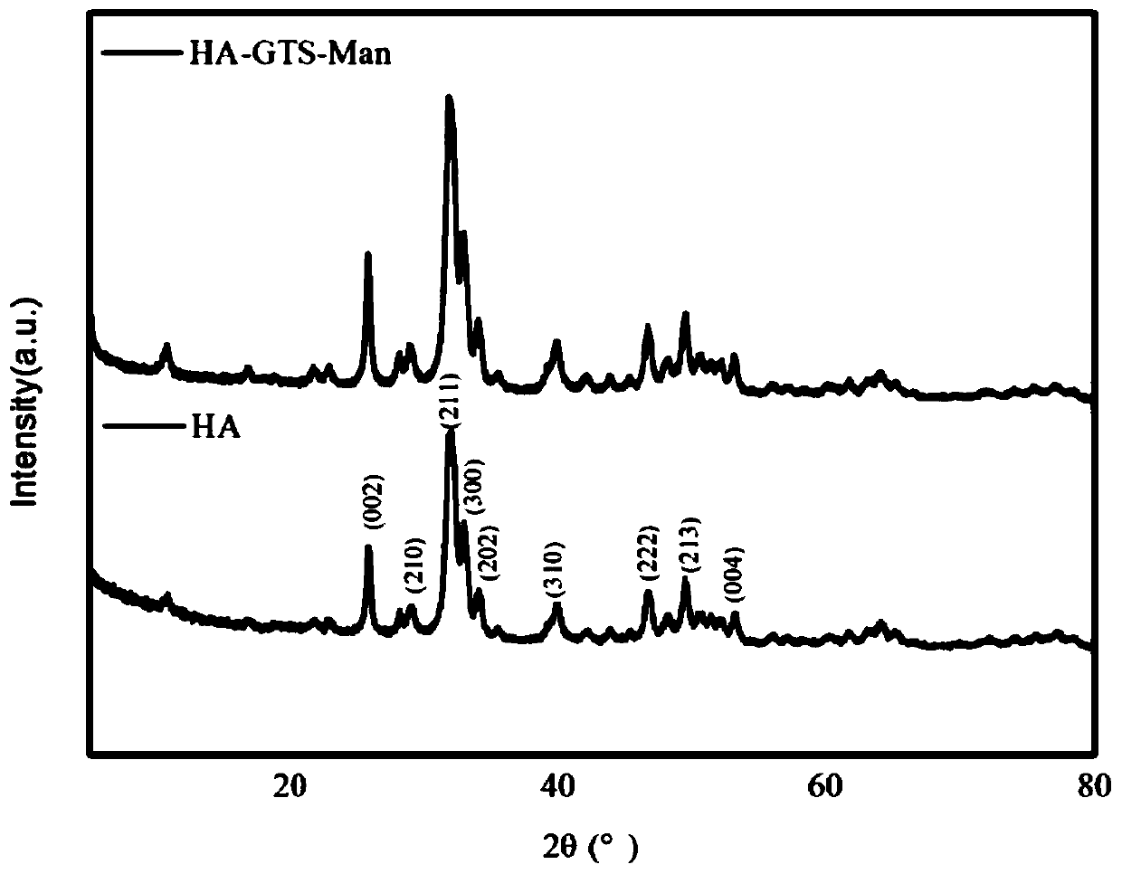 Targeting drug carrier based on nano-hydroxyapatite and construction method of nano-drug delivery system