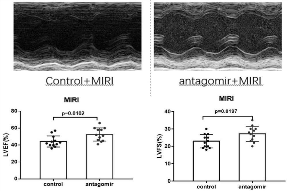 Application of miR-208a-3p antisense nucleic acid in treatment of myocardial ischemia reperfusion injury