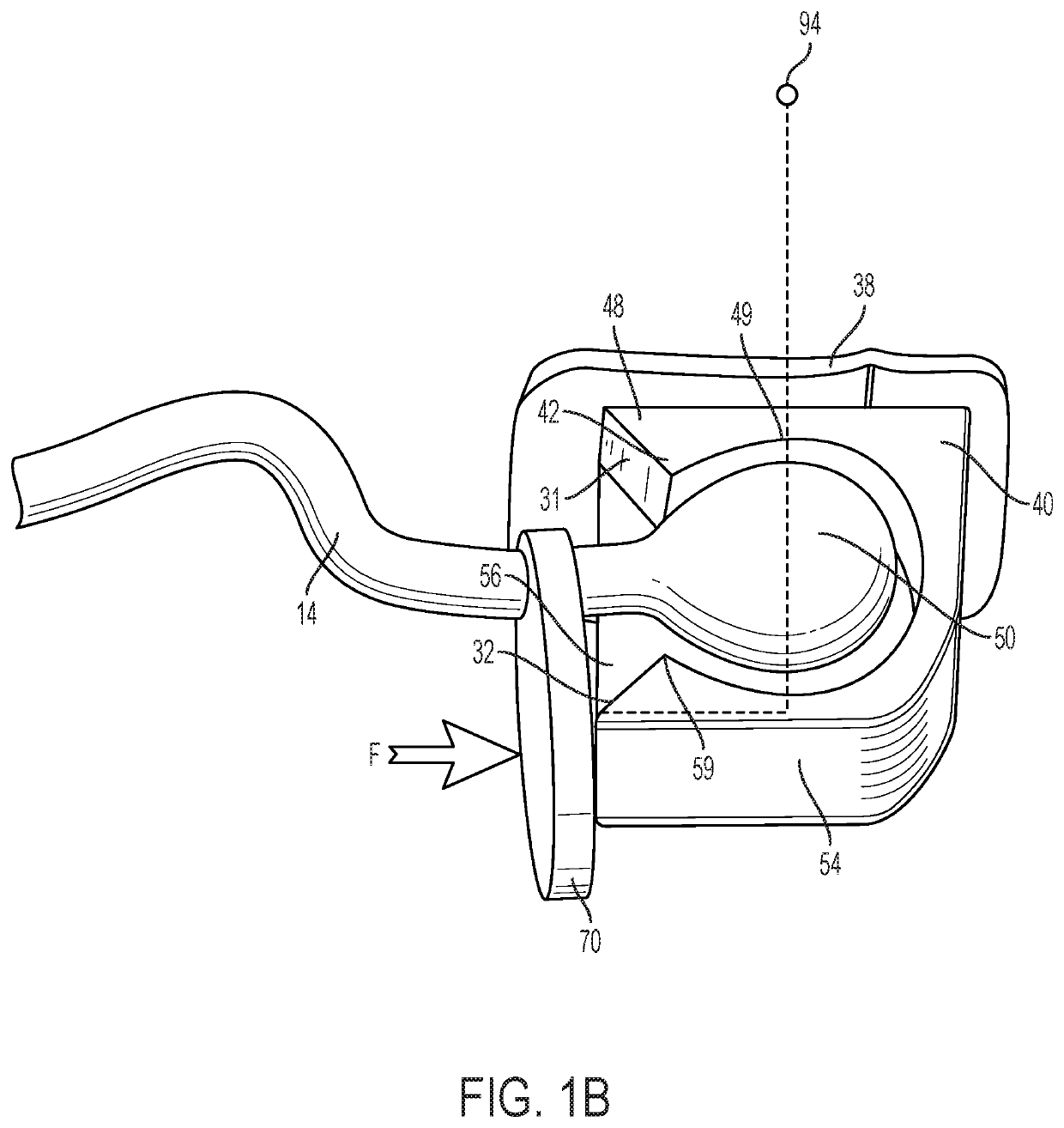 Orthopedic-orthodontic molar distalizer