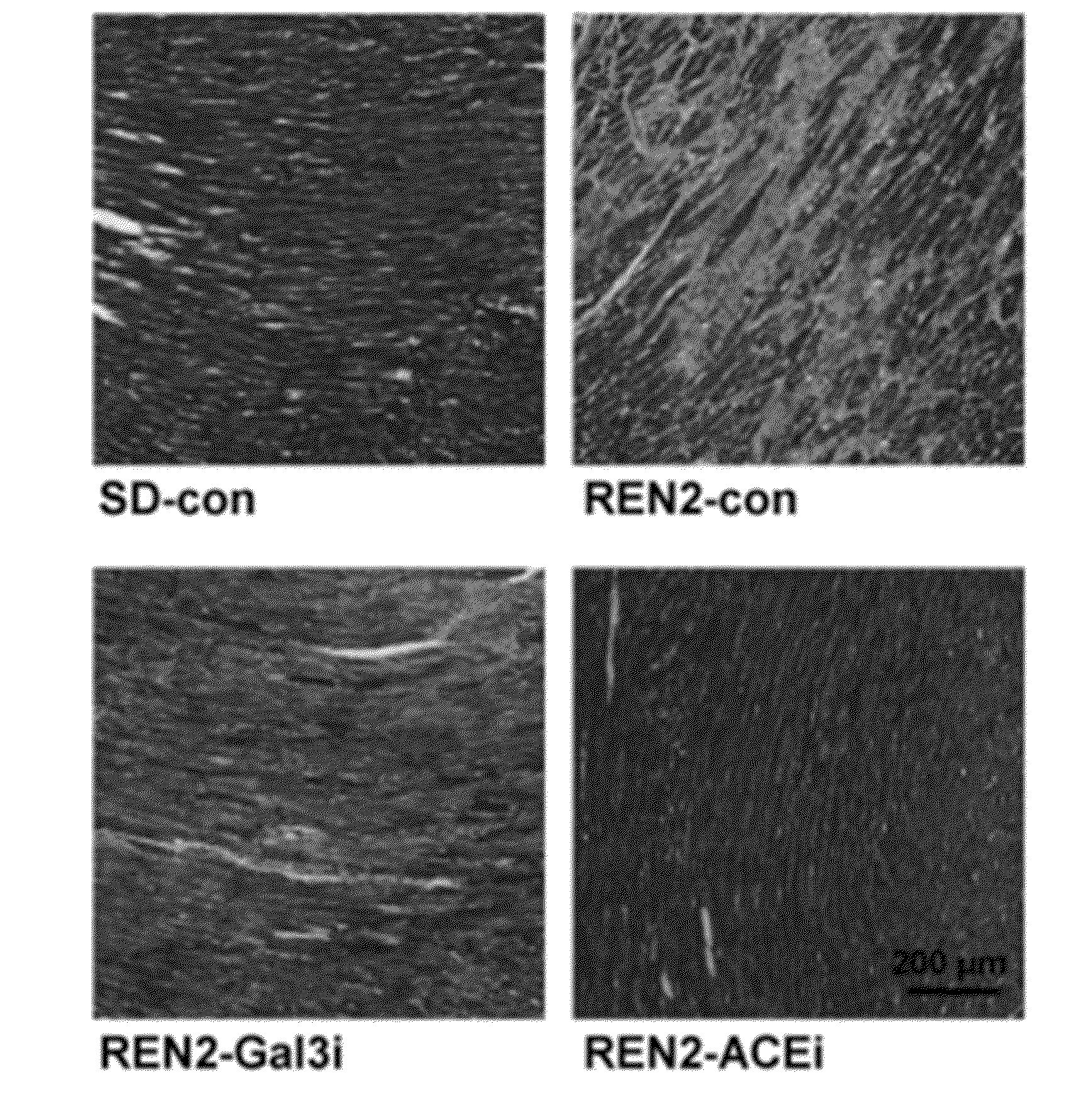 Inhibitors of galectin-3 and methods of use thereof