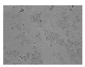 In-situ hybridization screening kit for mRNA (messenger Ribonucleic Acid) level of gene CD33 of prophase lesion of Alzheimer's disease (AD) and screening method and application thereof