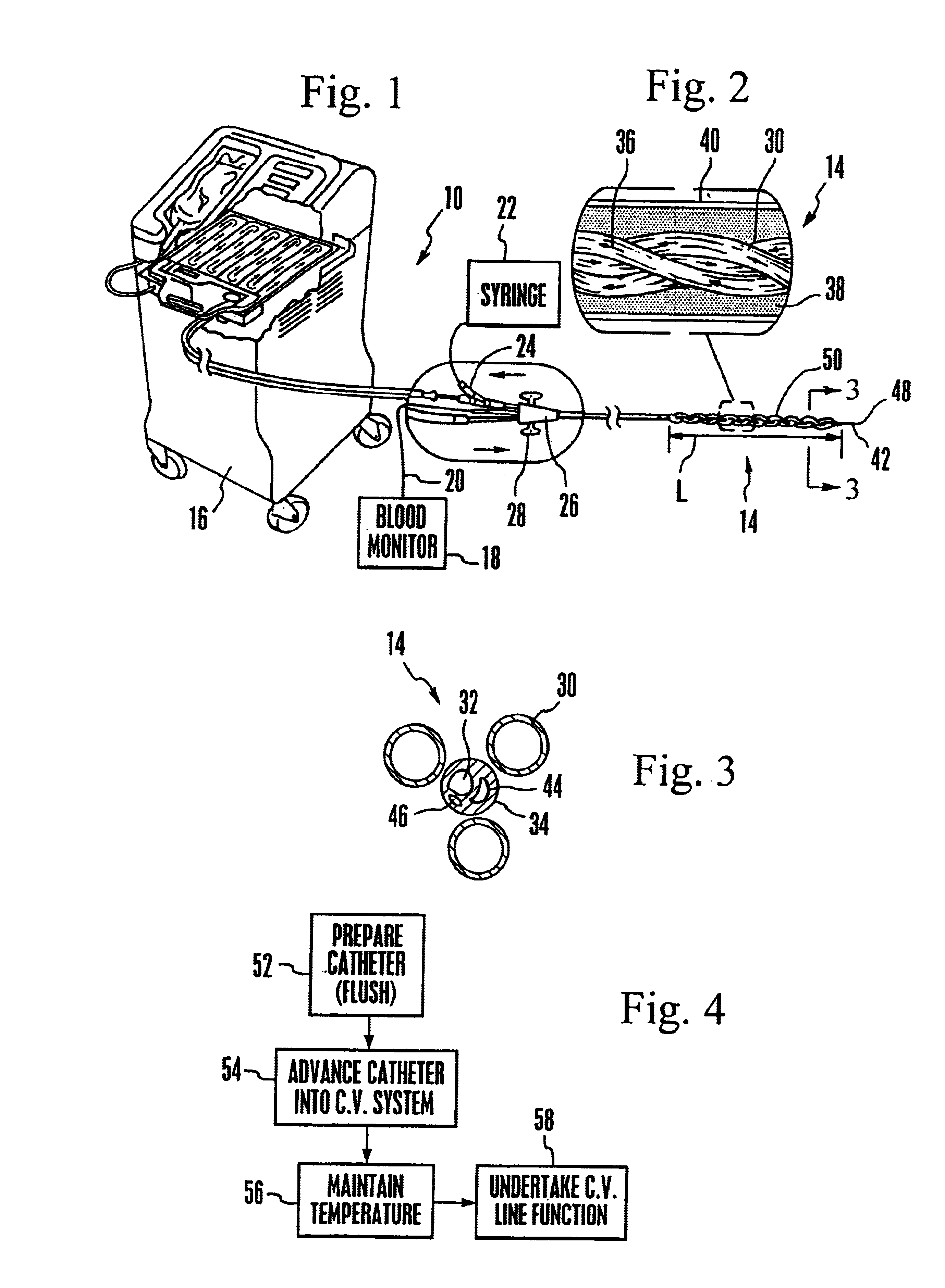 Method and system for patient temperature management and central venous access