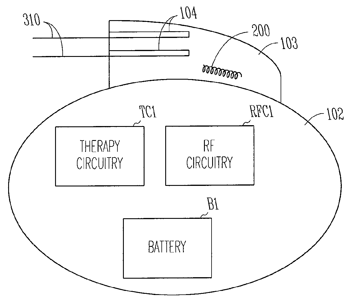 Antenna for an implantable medical device