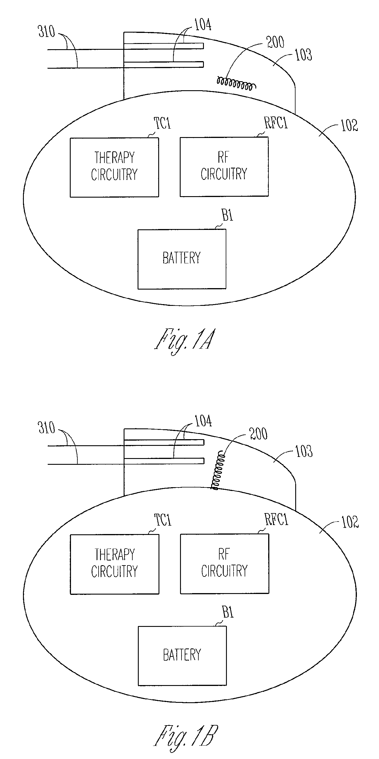 Antenna for an implantable medical device