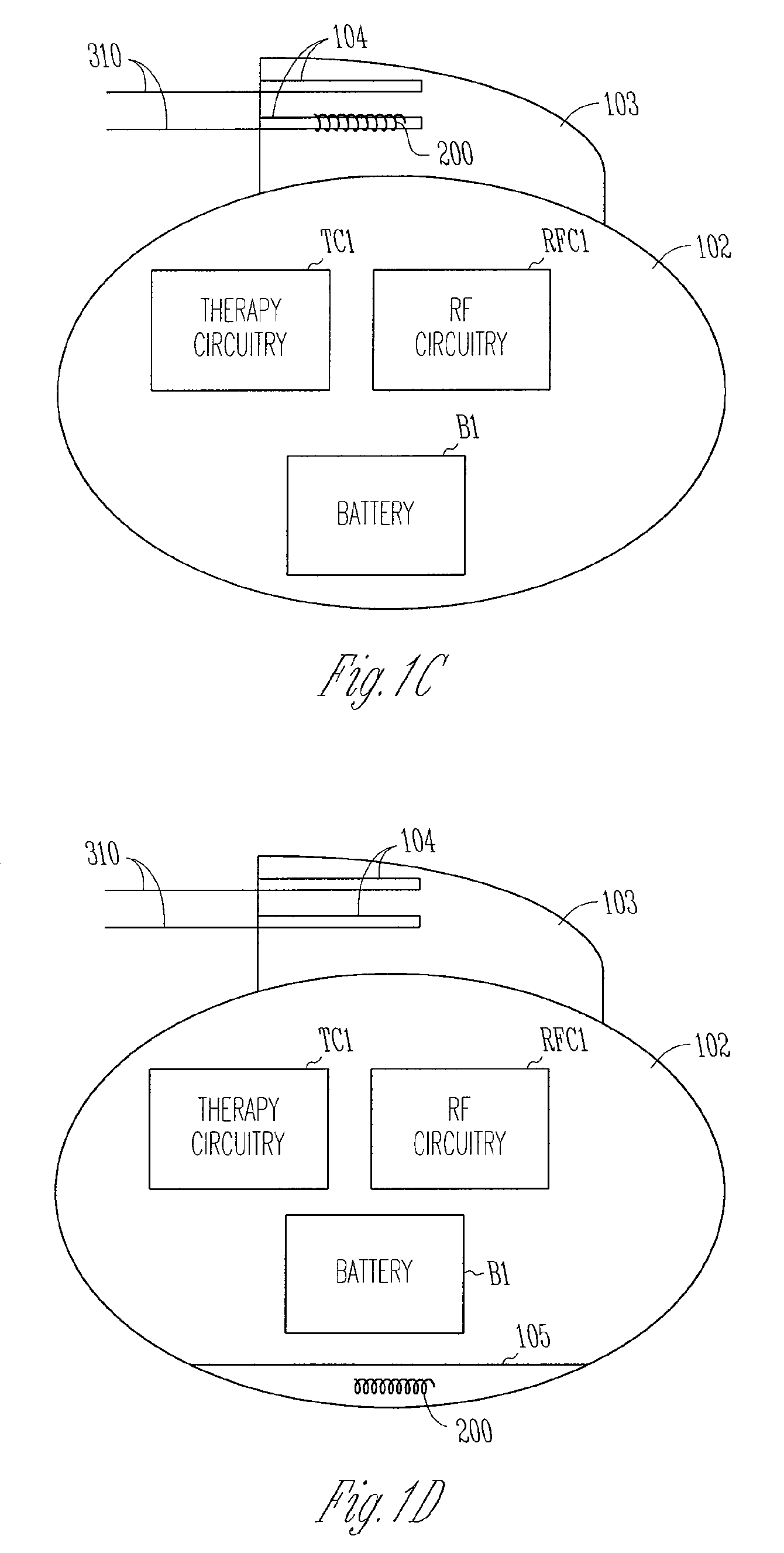 Antenna for an implantable medical device