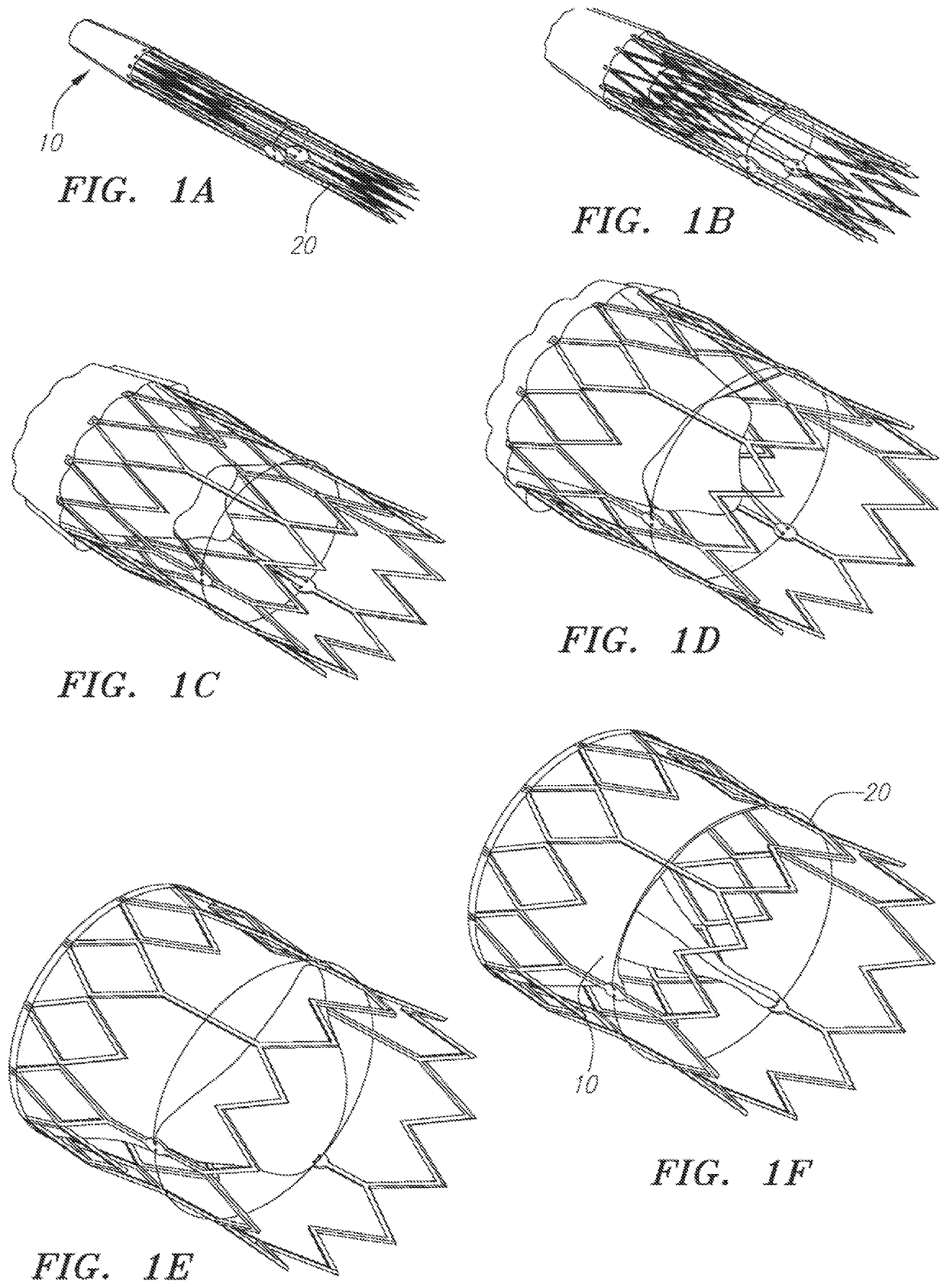 Percutaneous heart valve delivery systems