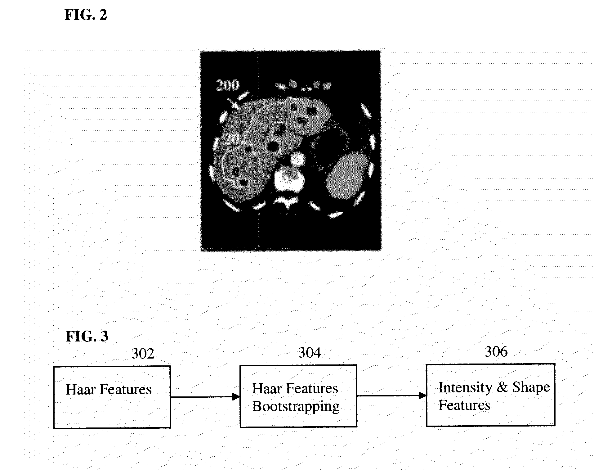 Method and System for Liver Lesion Detection