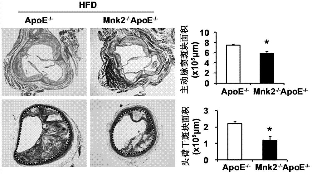 Function and application of MAPK (mitogen-activated protein kinase) signal-integrating kinase 2 in treatment of atherosclerosis