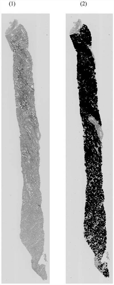 Auxiliary evaluation method for renal interstitial fibrosis, computer equipment and computer readable storage medium