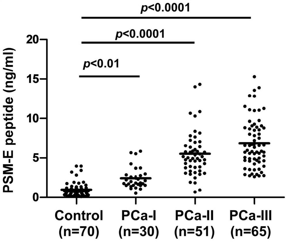 Application of mass spectrometry to detect the level of psm-e molecules in urine in the preparation of products for early diagnosis of prostate cancer