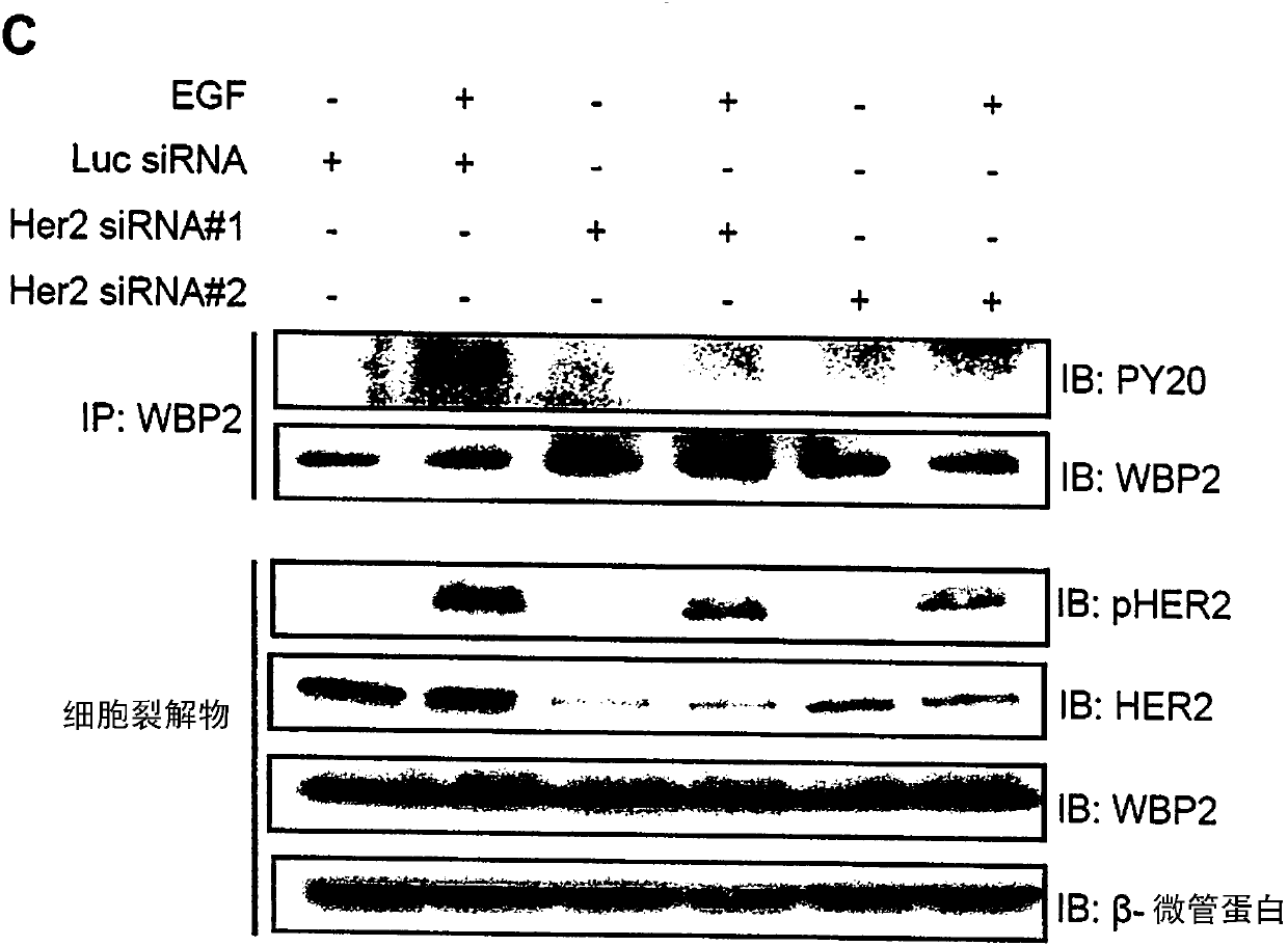 Wbp2 as a co-prognostic factor with her2 for stratification of patients for treatment