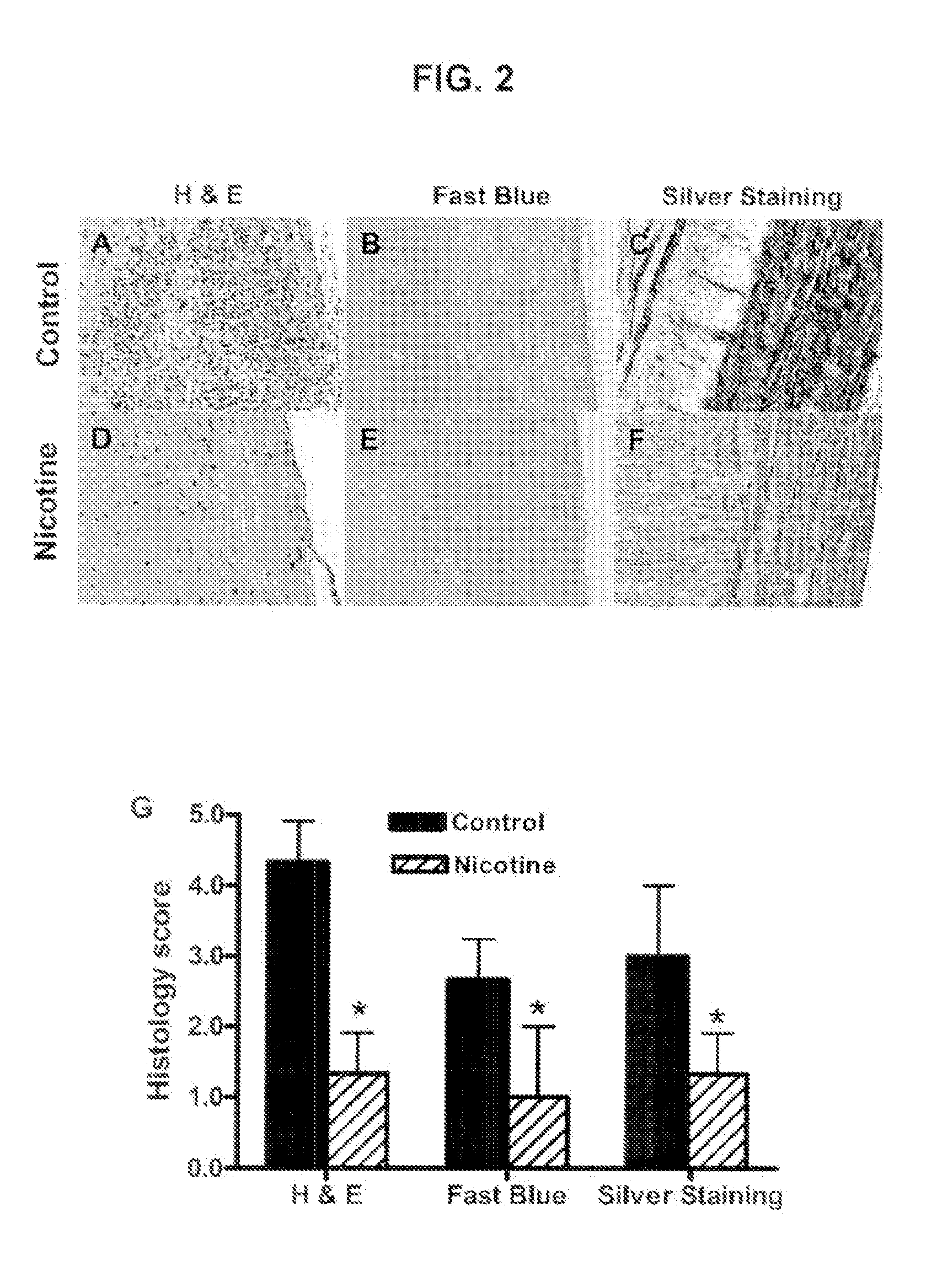 Nicotinic attenuation of CNS inflammation and autoimmunity