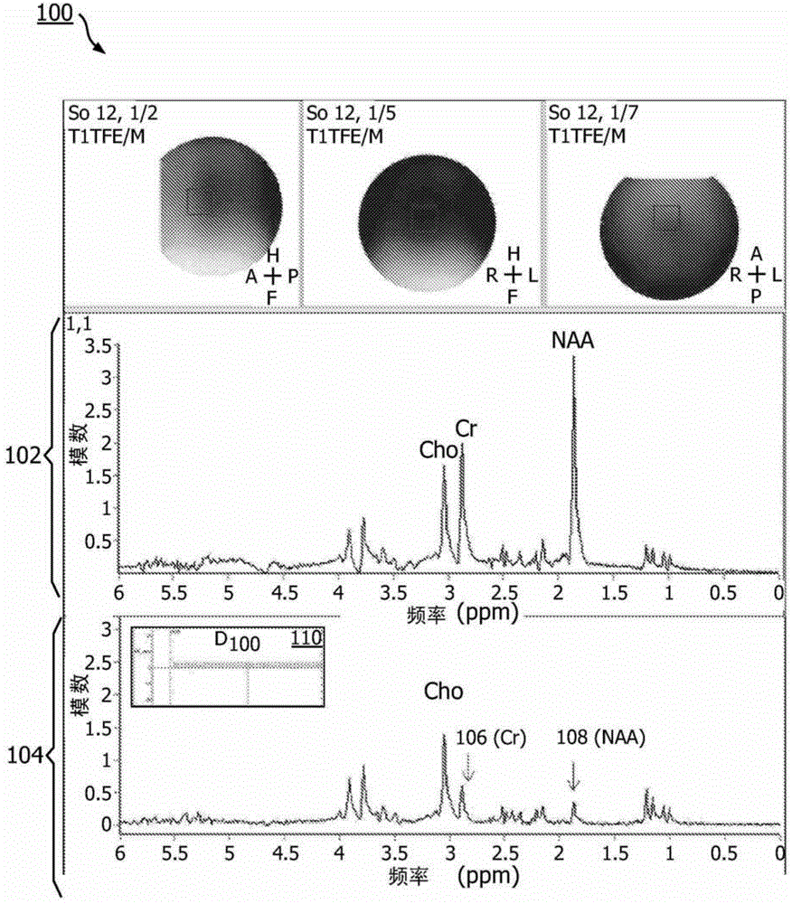 MR system and method for detecting metabolites