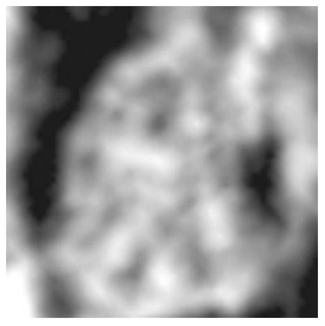Segmentation method for cerebellar earthworm part in ultrasonic image