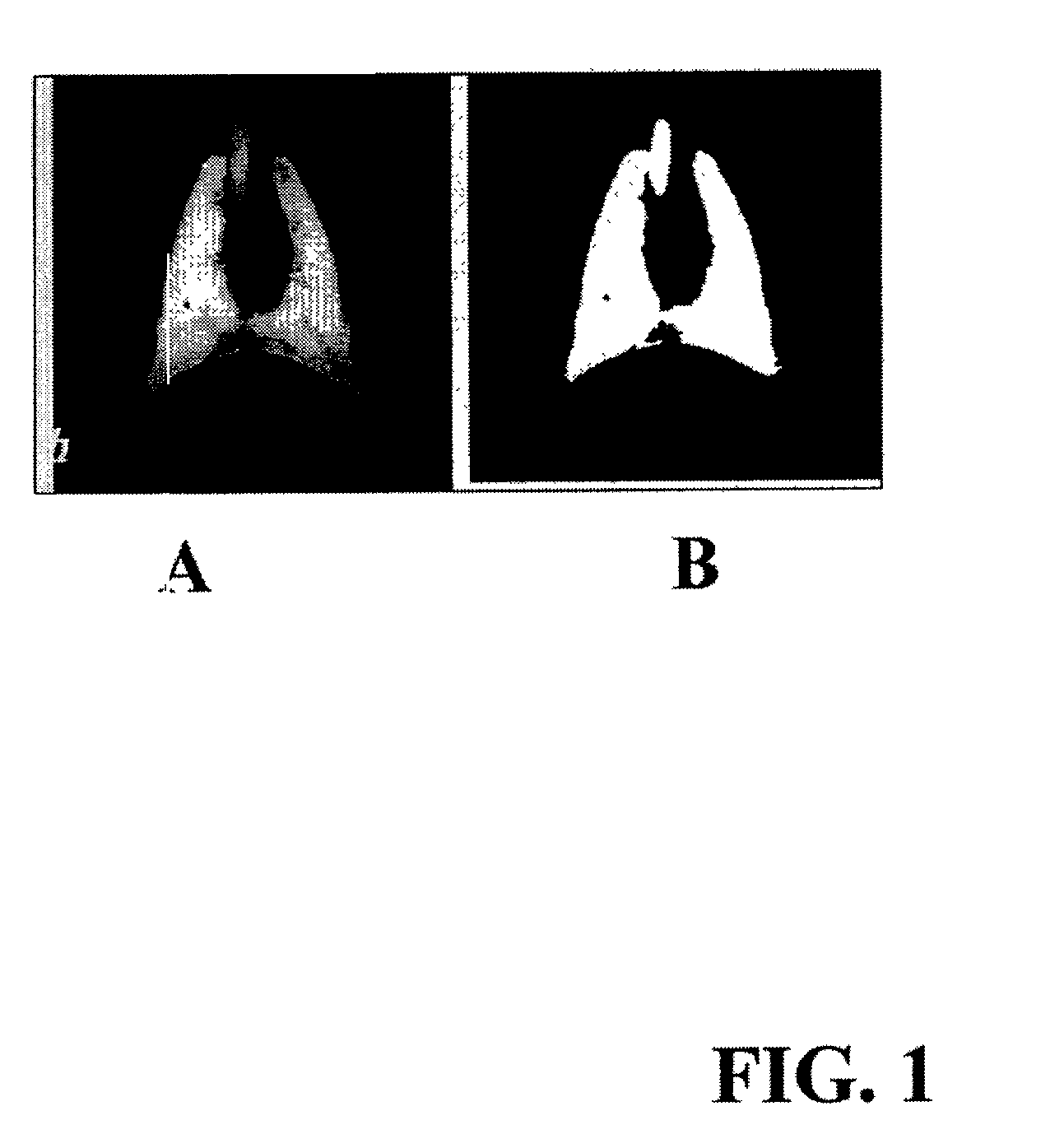 Equilibration method for high resolution imaging of lung compliance and distribution of functional residual capacity