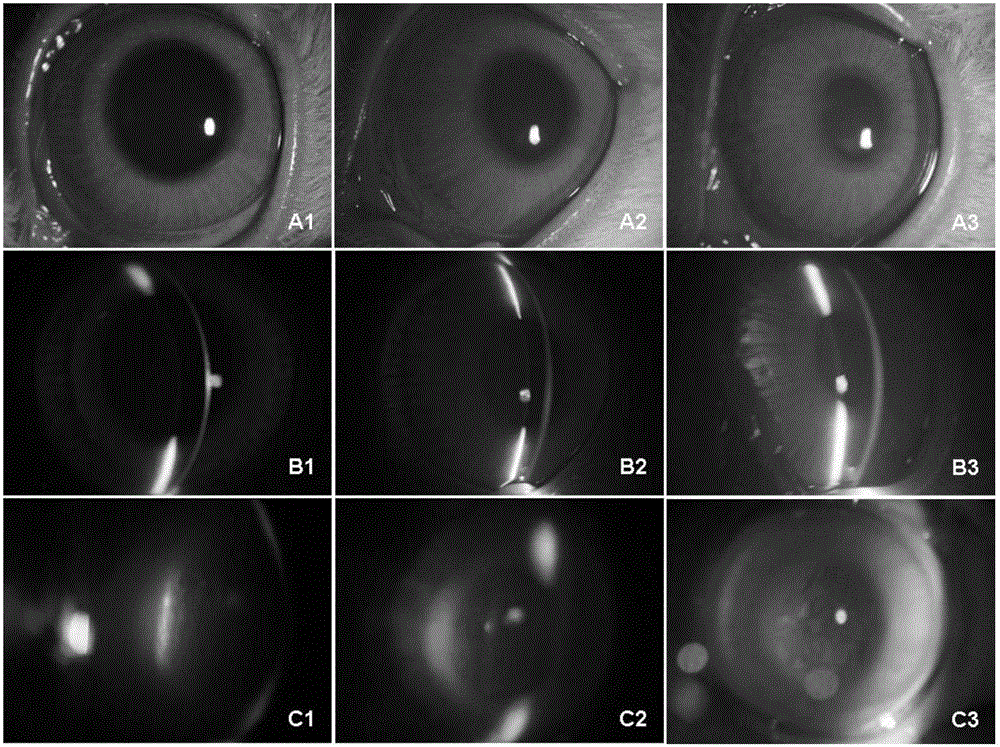 Application of injectable hydrogel in preparing intraocular filling materials