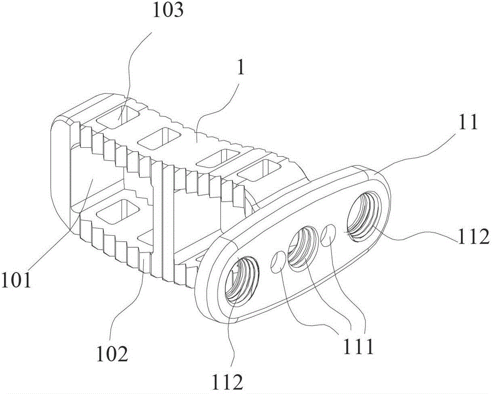 Integrated Lumbar Intervertebral Titanium Plate Fusion Cage