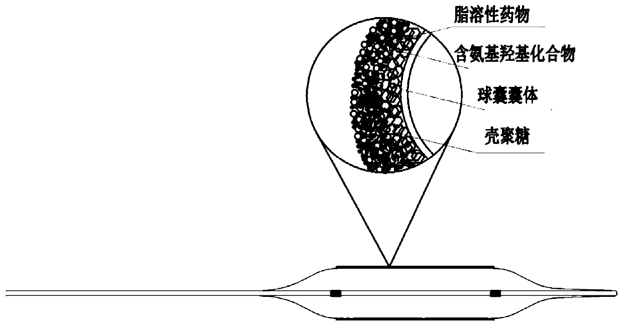A preparation method of a drug balloon, the prepared drug balloon and its application