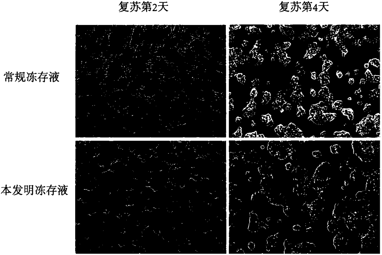 Serum-free induced pluripotent stem cell cryopreservation liquid and cryopreservation method